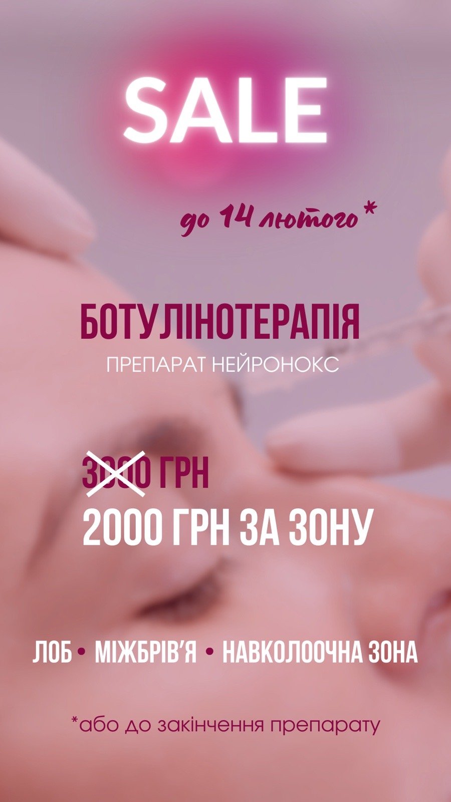 Акція на ботулінотерапію 5 Клуб краси Контур, Ужгород